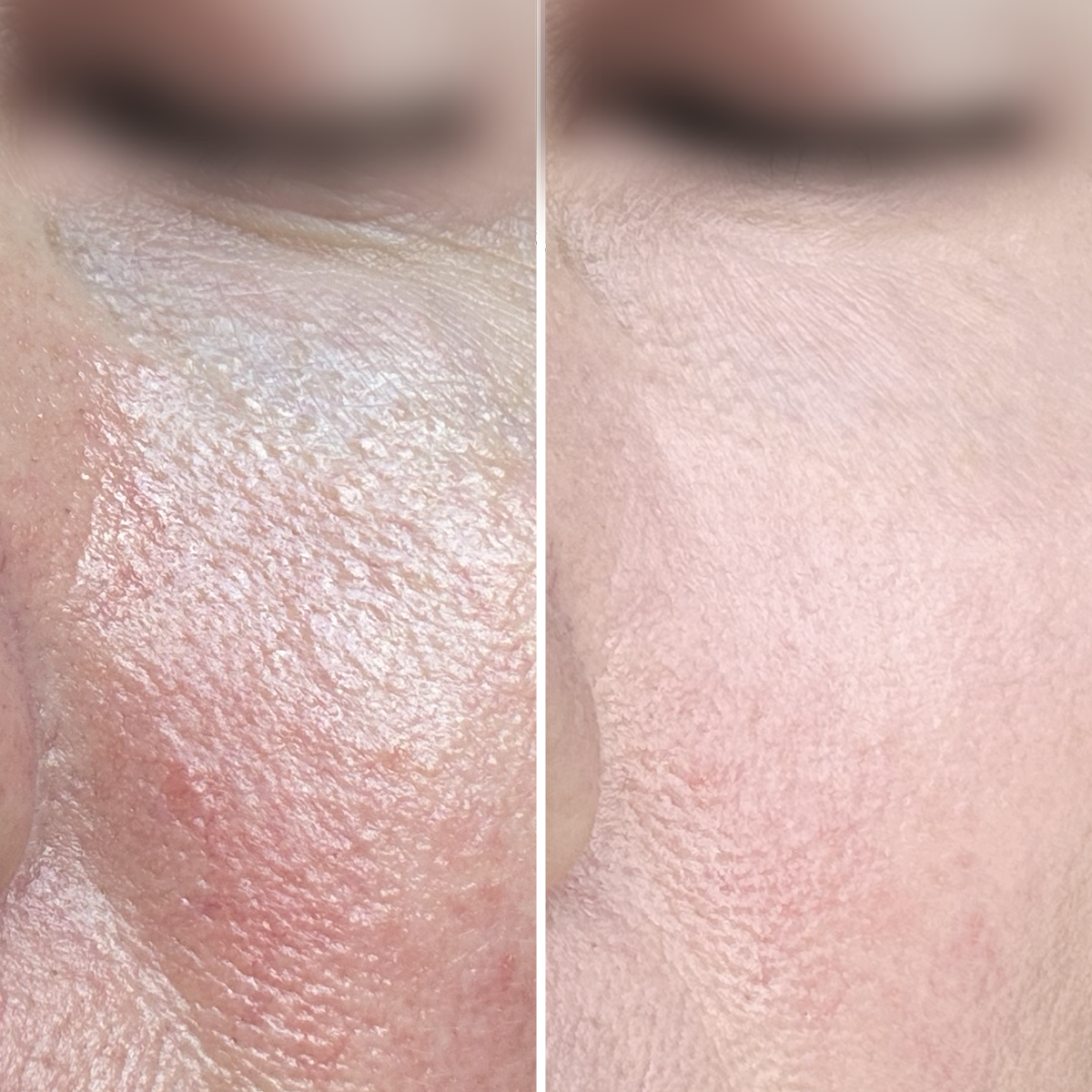 Airbrush Blur Balm  Cadeau gratuit - Avant et après