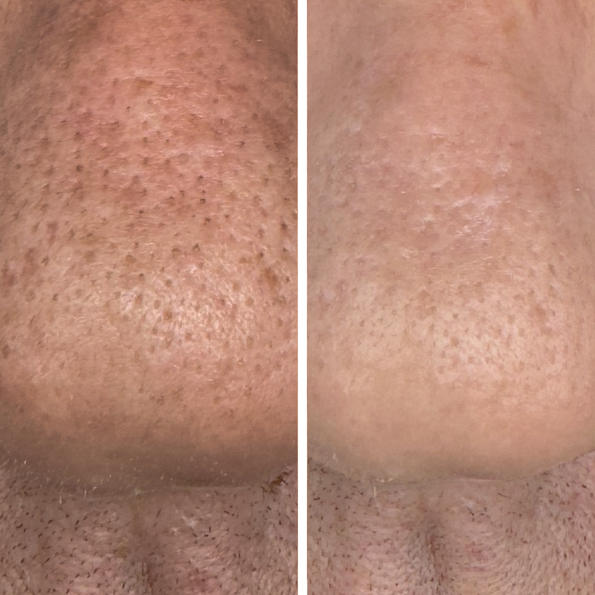 Airbrush Blur Balm - Before & After