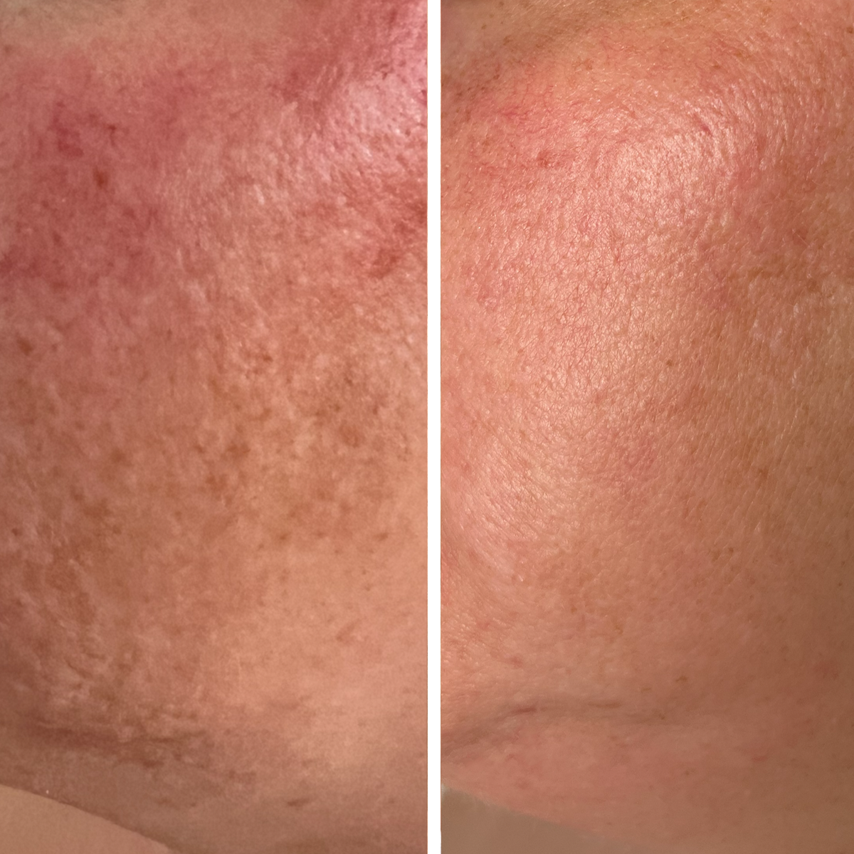 Cellular Blue Repair Serum - Before & After