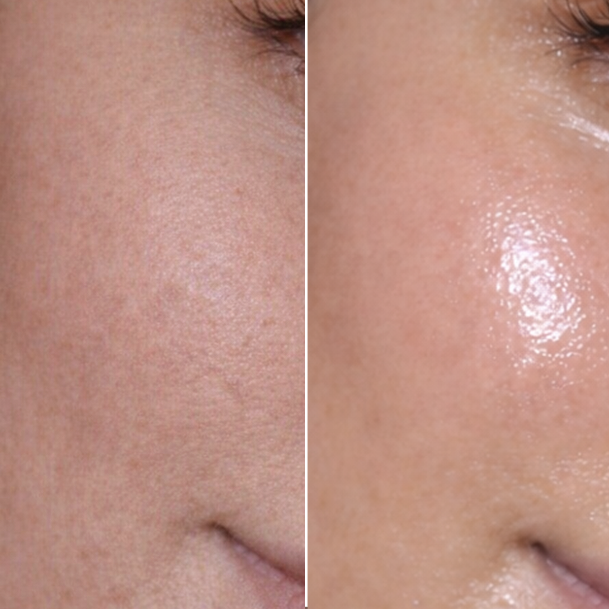 Liquid Glass Hydrogel Mask - Before & After