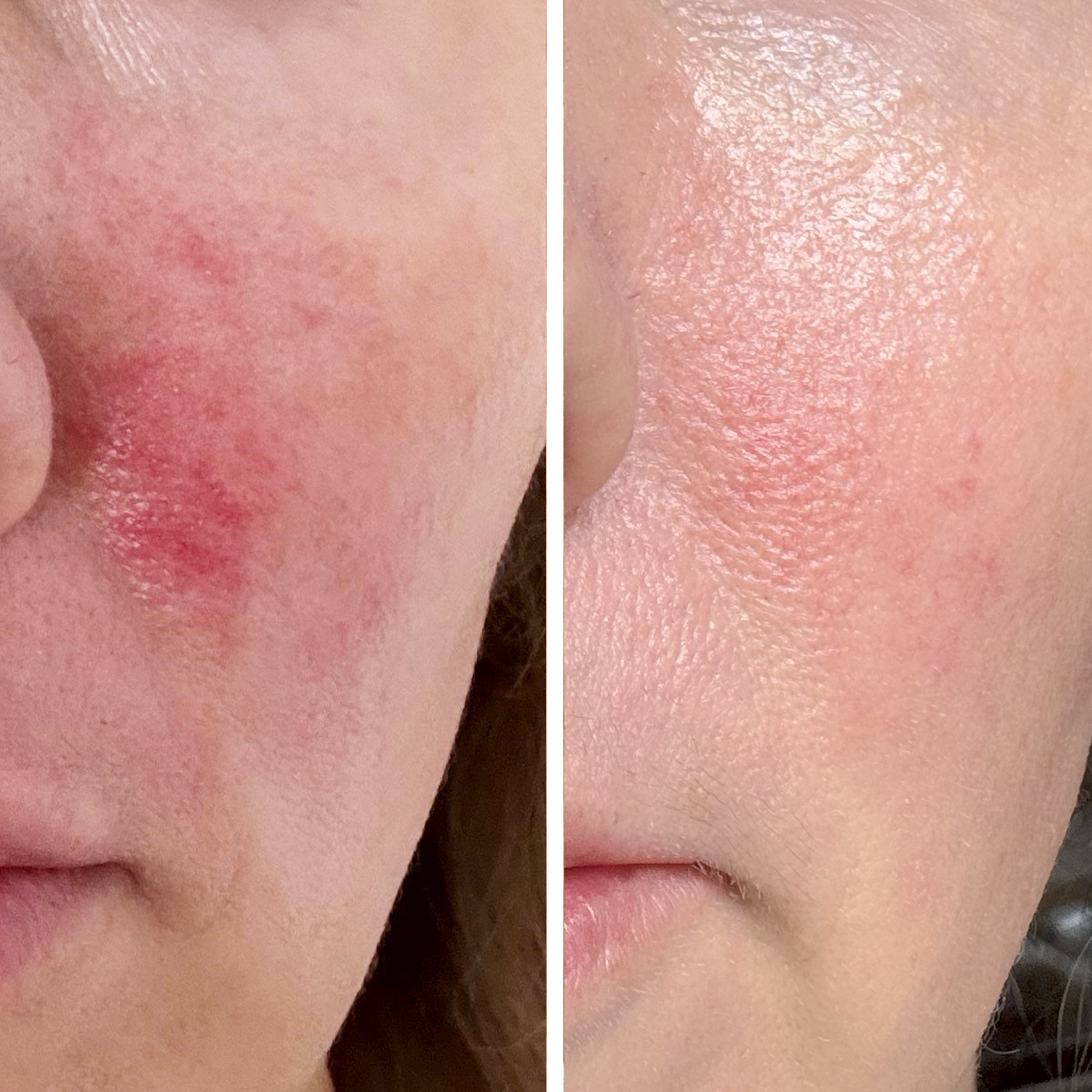 Barrier Repair Serum CICA-M - Before & After