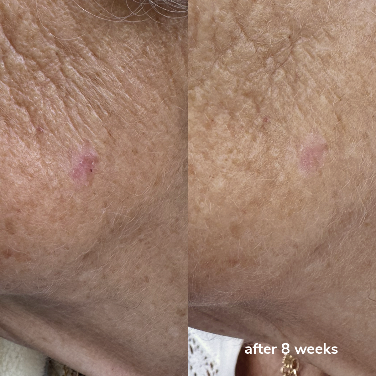 Milky Shake Double Cleanser - Before & After