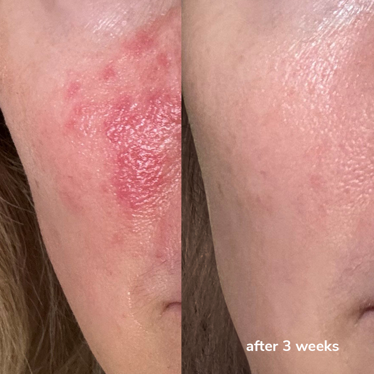Barrier Repair Serum CICA-M