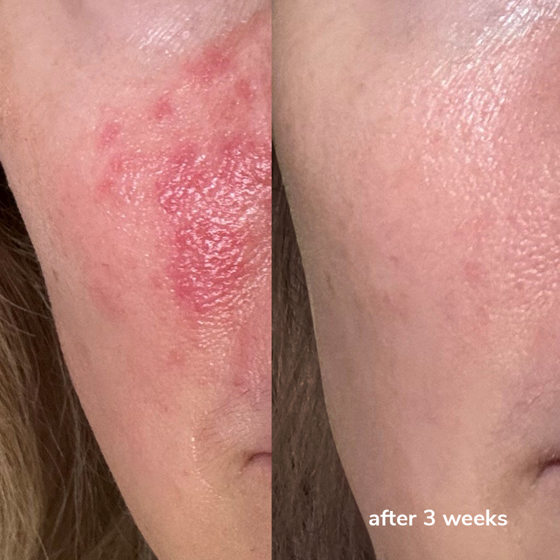 Barrier Repair Serum CICA-M