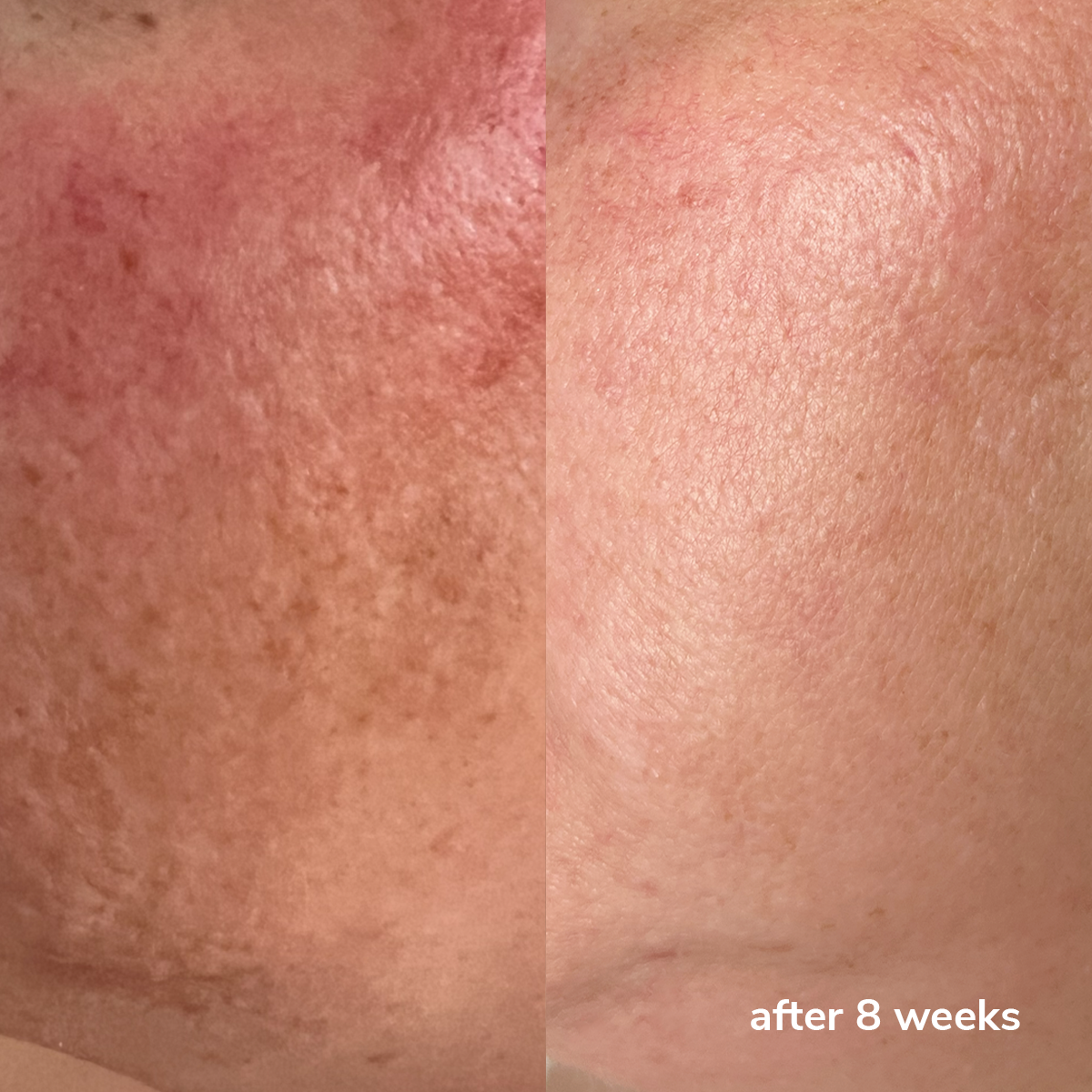 Cellular Blue Repair Serum  Voor & Na