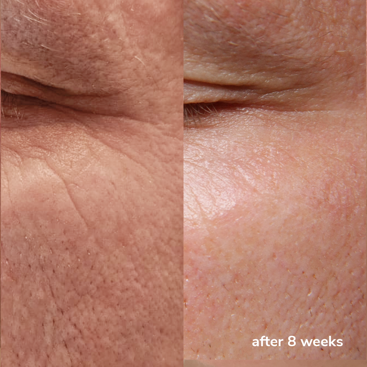 Eye Peptides 10% Cream