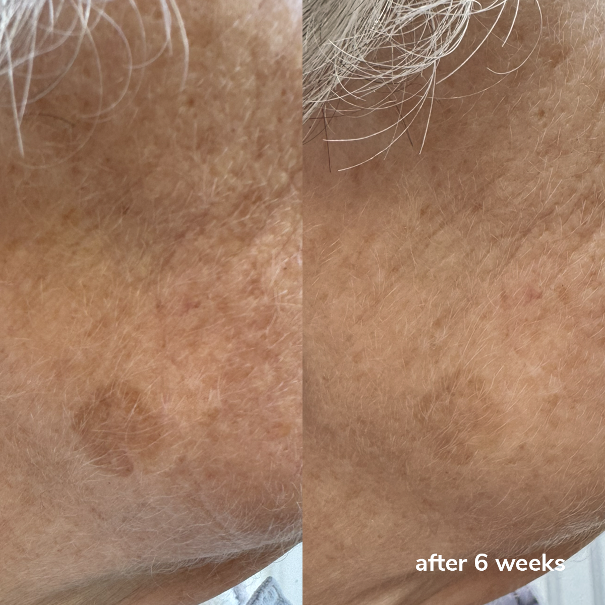 Daily Shield SPF50+ - Before & After