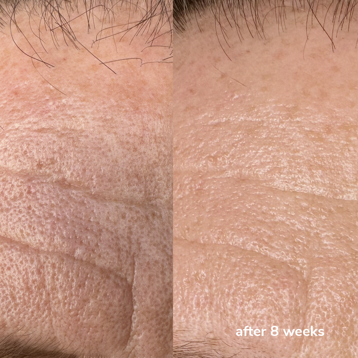 Daily Shield SPF50+ Refill - Before & After