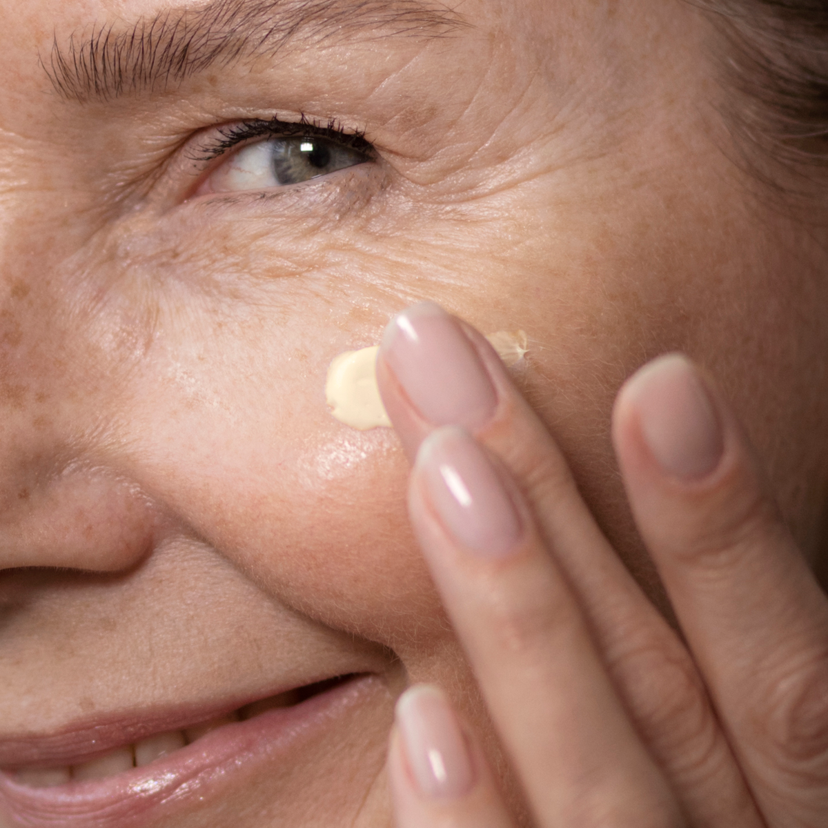 Retinoid 5% Peptide Cream  Vorher und Nachher