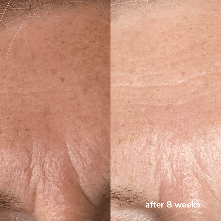 SignalNeedling Correct Cream  Cleenlab.